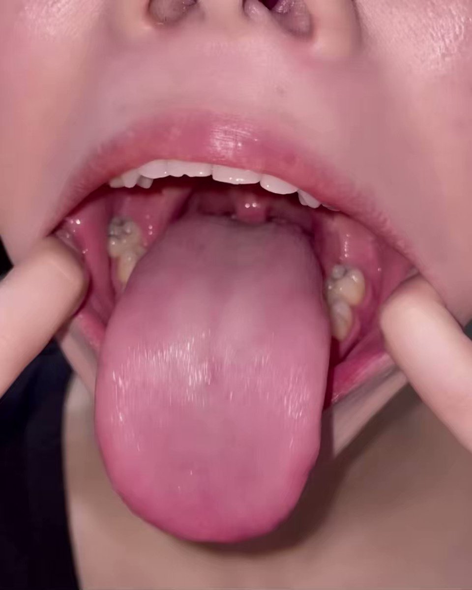 tuldx5vbvcl-e4ci