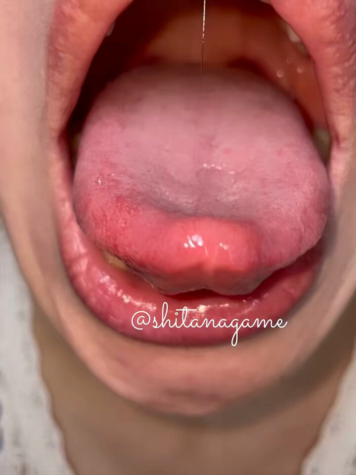 siipyfwxeloyrg_m