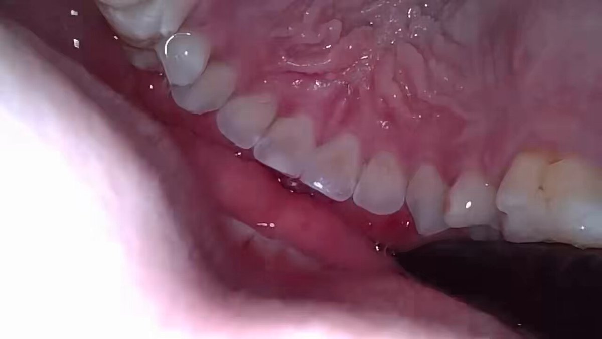 5pcrosqrakgspda9