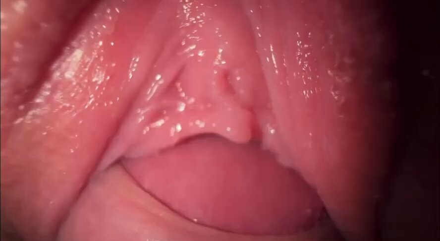 5c8kosqjnn_x_wdx