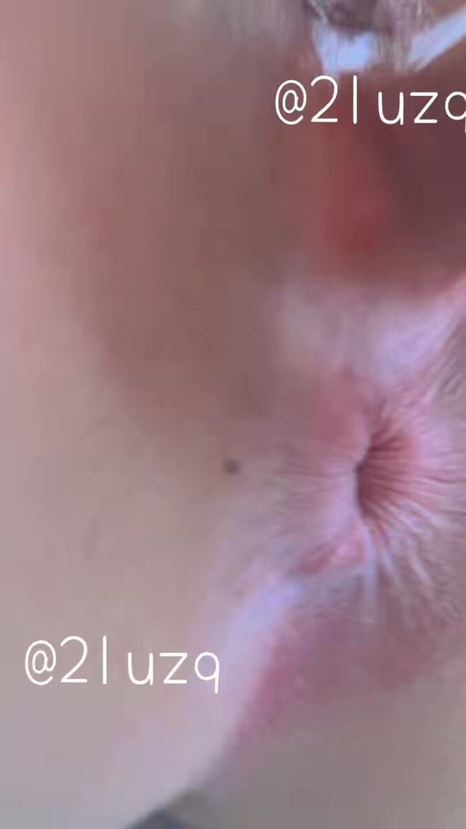 b94xzrx723bzgctl