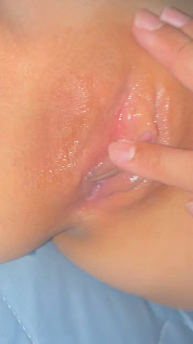 7hnkblknn5zy2vsd