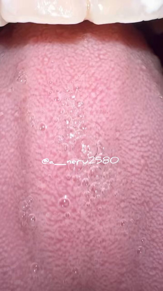 lurme5cshmbib8vk