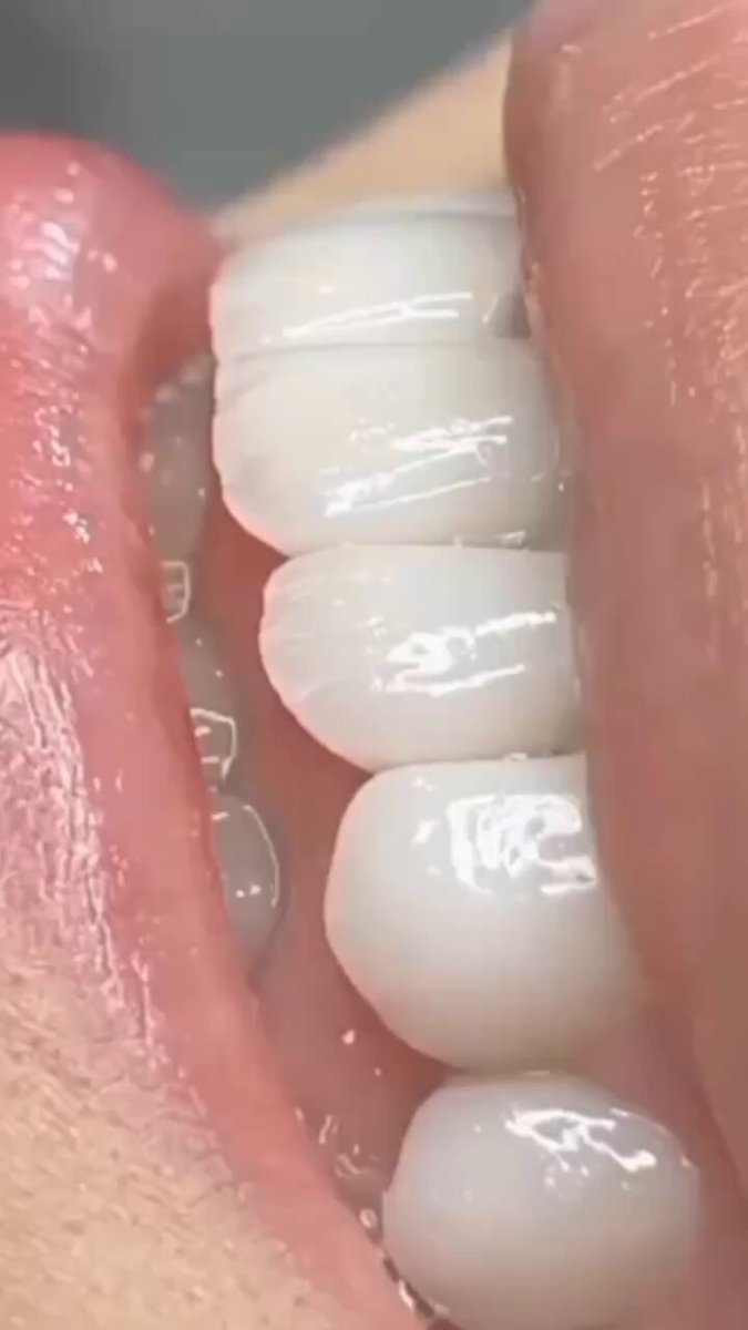 3dkagh6iawprzrrq