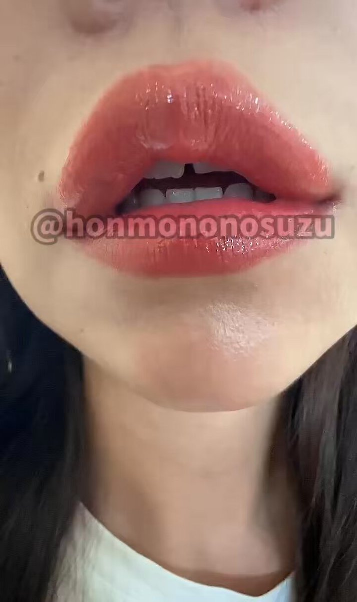 znq42y43lhyprodm